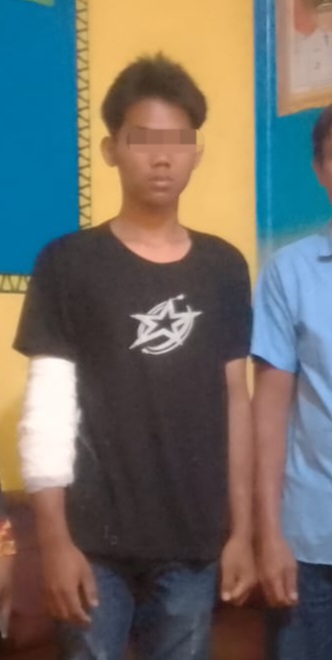 Siswa SMA Negeri 2 Menggala Diduga Dikeroyok hingga Patah Tangan, Keluarga Soroti Tanggung Jawab Sekolah